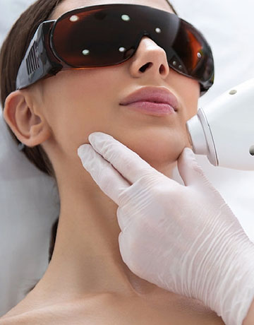 Woman in protective goggles receiving a laser treatment along her jaw