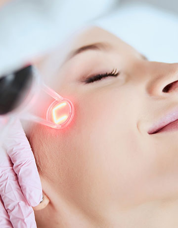 Laser handpiece with a red glow treating a woman's cheek