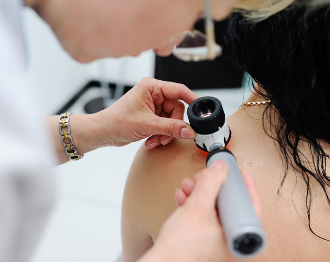 Provider examining a mole on a woman's shoulder with a dermatoscope